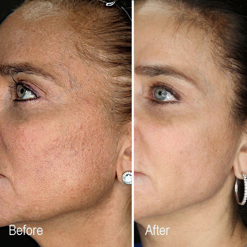 Ageless Moisturizer™