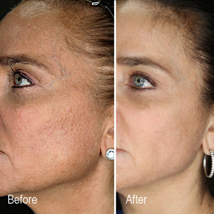 Ageless Moisturizer™